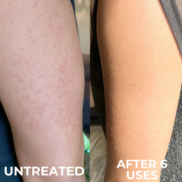 Results for Mara K., 34